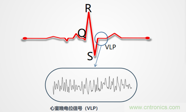 解決心電監(jiān)測行業(yè)難題，曼森伯格的濾波技術(shù)獲國家知識產(chǎn)權(quán)局發(fā)明授權(quán)