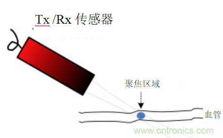 超聲系統(tǒng)的信號鏈設(shè)計(jì)注意事項(xiàng)